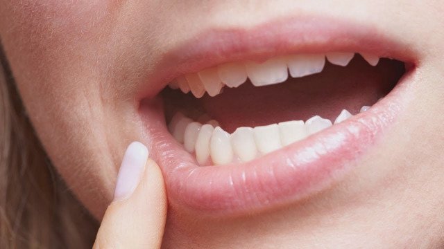 Dejavniki tveganja za nastanek parodontalne bolezni